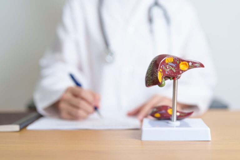 Esteatose hepática: o fígado gorduroso que a maioria das pessoas tem e não sabe